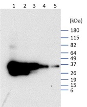 GFP | Green fluorescent protein (VENUS) in the group Tag Antibodies / GFP/EGFP/BFP/CFP/YFP/RFP at Agrisera AB (Antibodies for research) (AS18 4227)